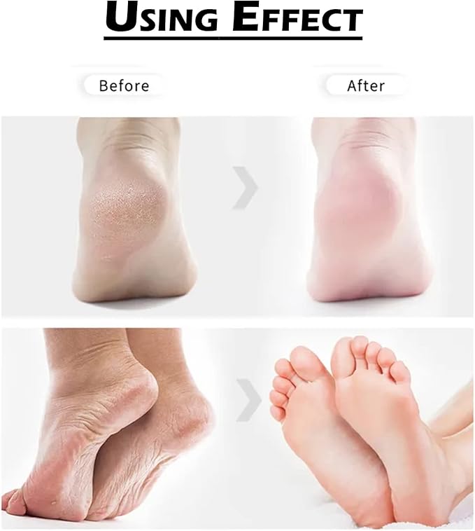 Electronic Foot File Replacements for Amope 1 Extra&4 Extra&4 Regular