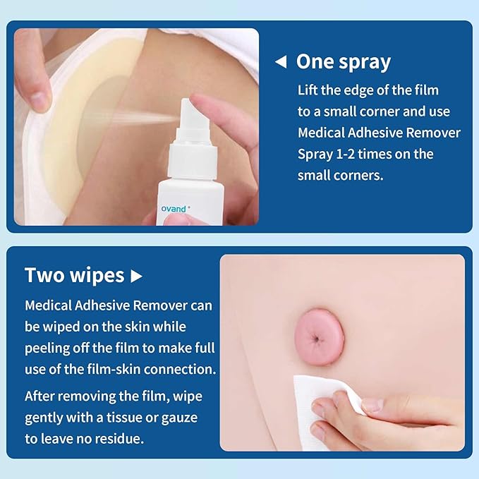 Medical Adhesive Remover Spray 1 oz.No-Sting Tape(4 Bottles)