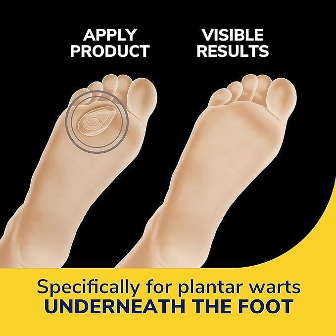 Dr. Scholl's Plantar WART Remover HYDROGEL 12 Discs 10 Cushions, 12 Treatments
