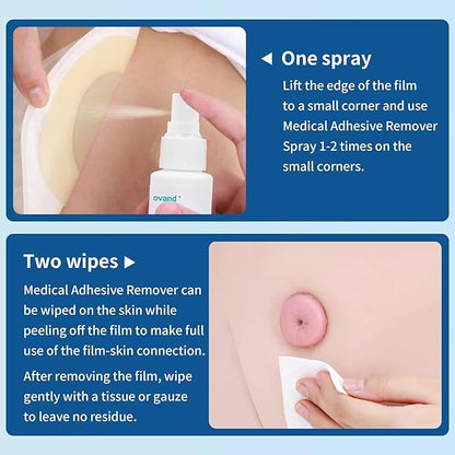 Medical Adhesive Remover Spray 1 oz.No-Sting Tape（4 Bottles）