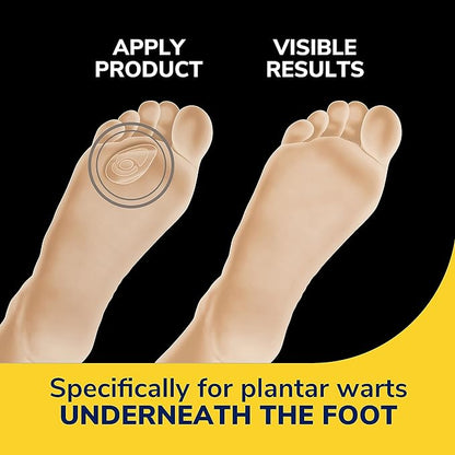 Dr. Scholl's Plantar WART Remover HYDROGEL 12 Discs 10 Cushions, 12 Treatments
