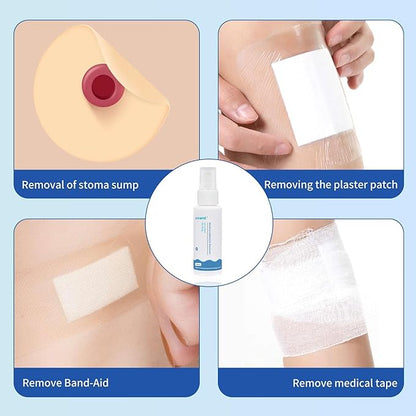 Medical Adhesive Remover Spray 1 oz.No-Sting Tape（4 Bottles）